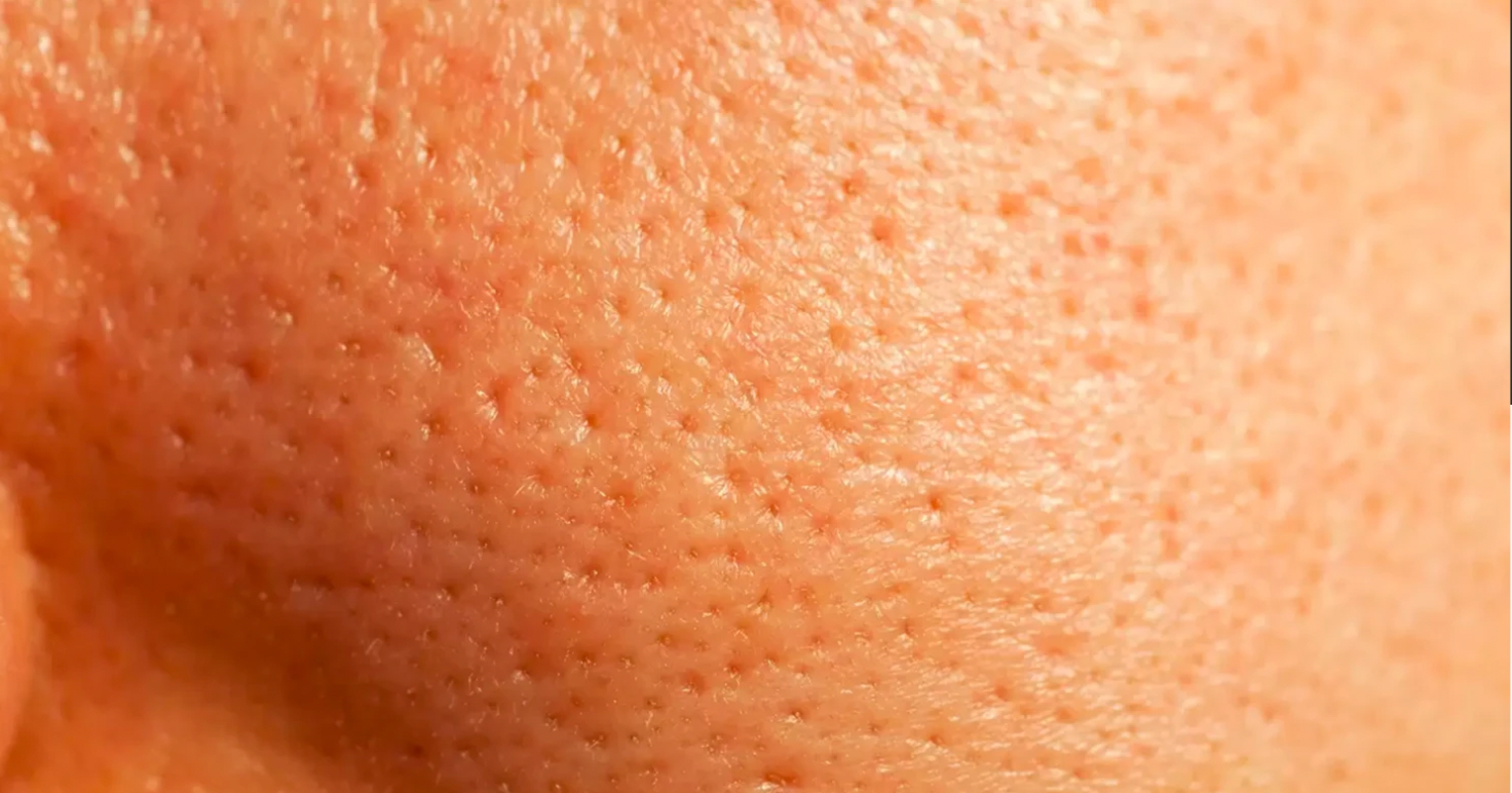 What are pores?
