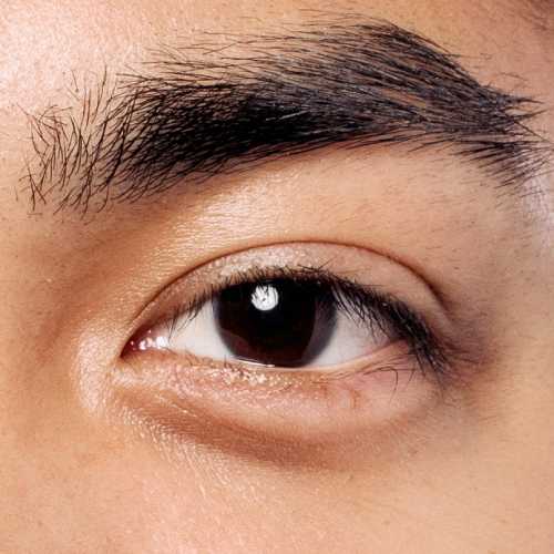 Dark circles image