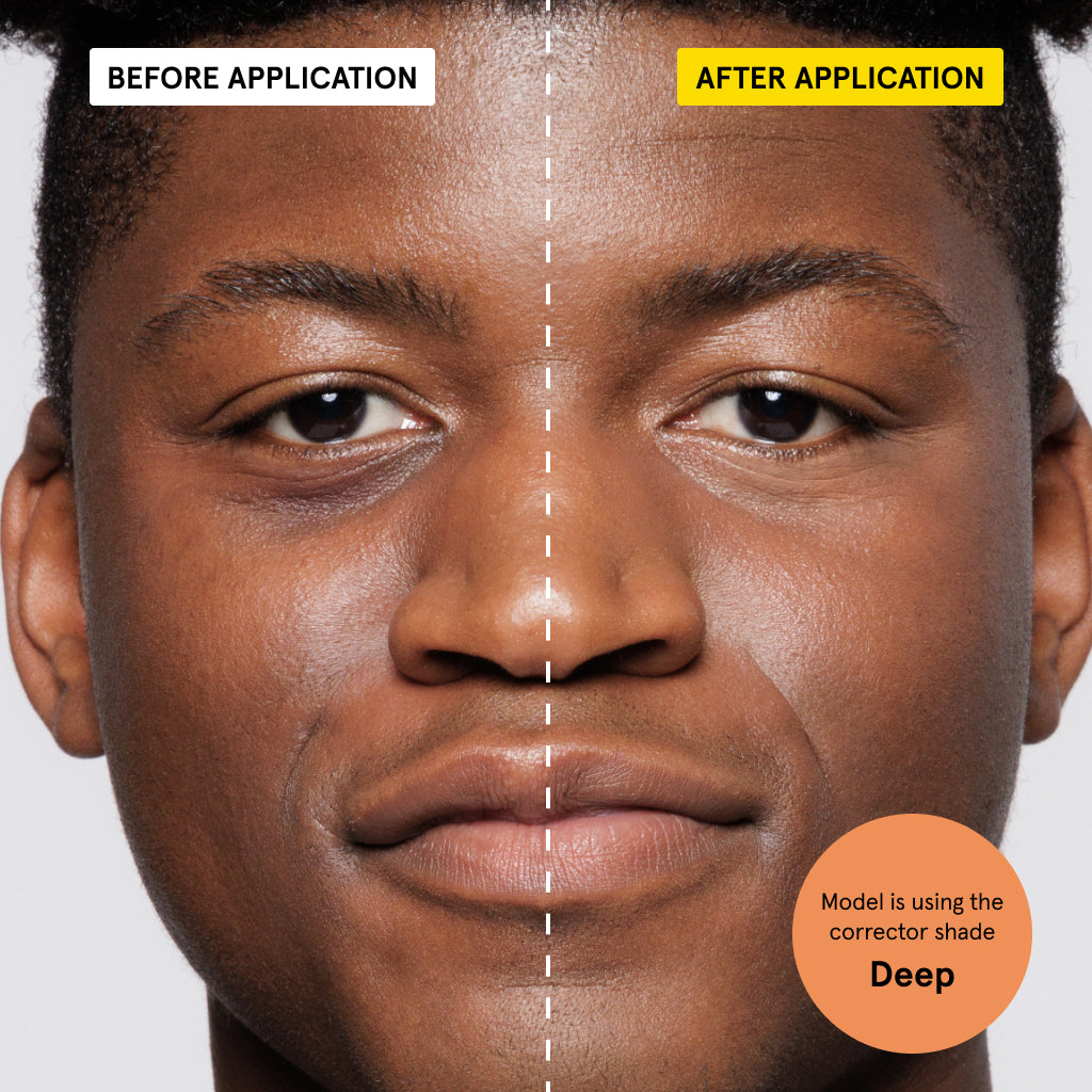 Split close-up of a model’s face showing before and after applying deep shade corrector to reduce dark under-eye circles.