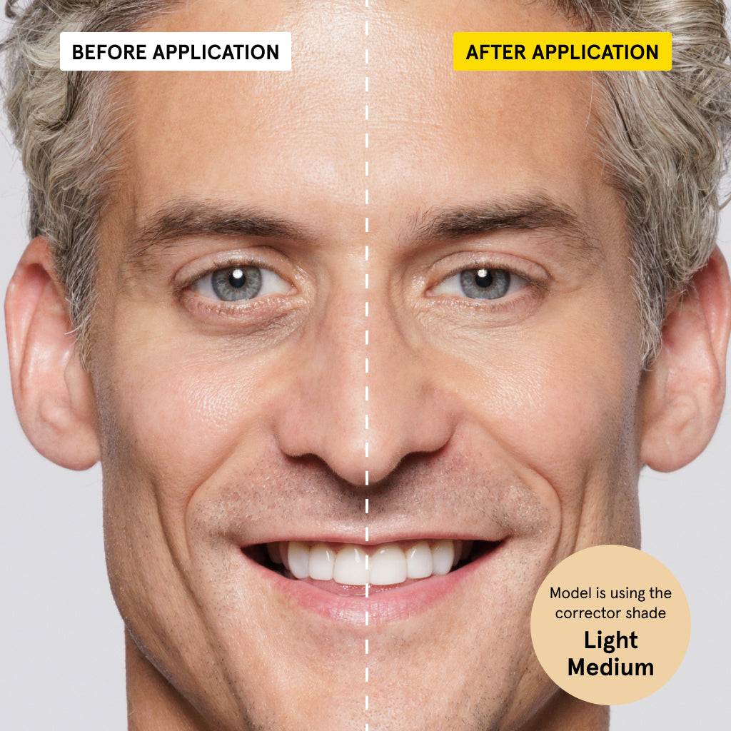 Split-face comparison showing under-eye dark circles reduced after applying medium light concealer on male model's face