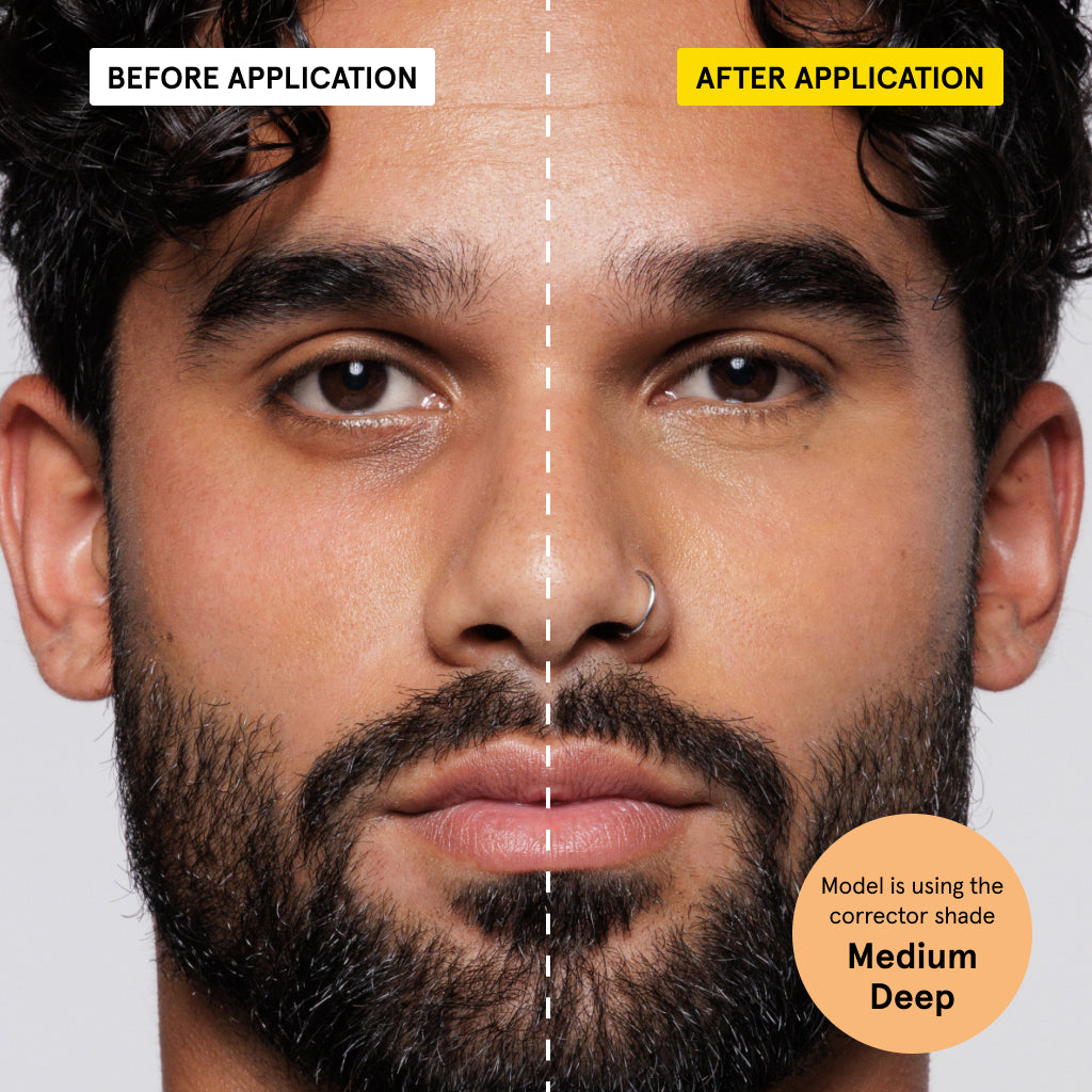 Split-face close-up showing medium deep shade corrector application on dark under-eye circles, enhancing even skin tone and brightness