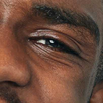 Wrinkles image